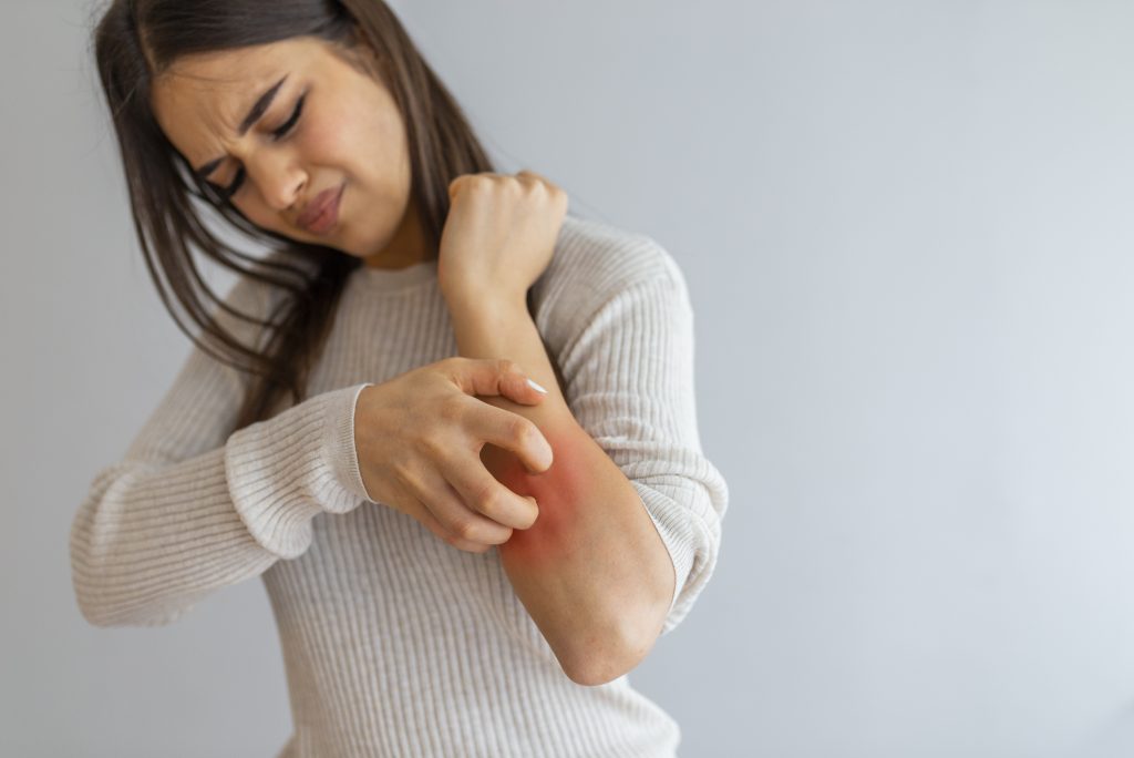 Woman with red, itchy forearm.