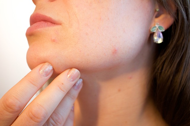 acute vs chronic folliculitis