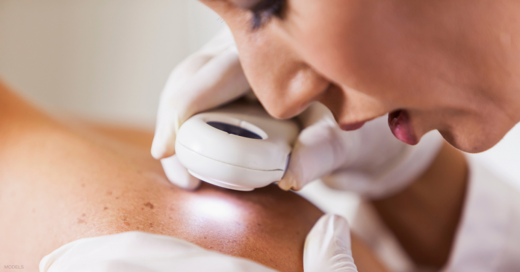 Female dermatologist checking for skin cancer