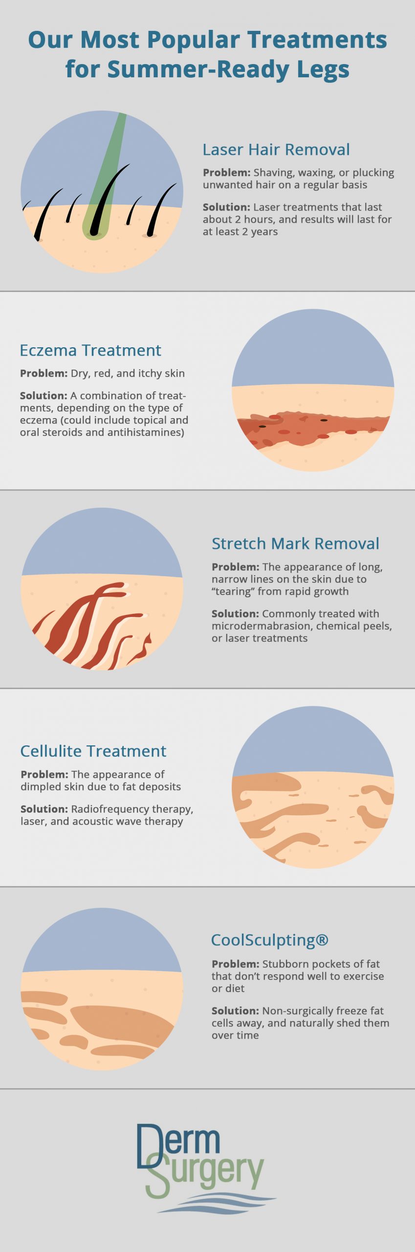 5 Quick Treatments for Summer-Ready Legs | Stretch Mark Removal & More |  DermSurgery Associates