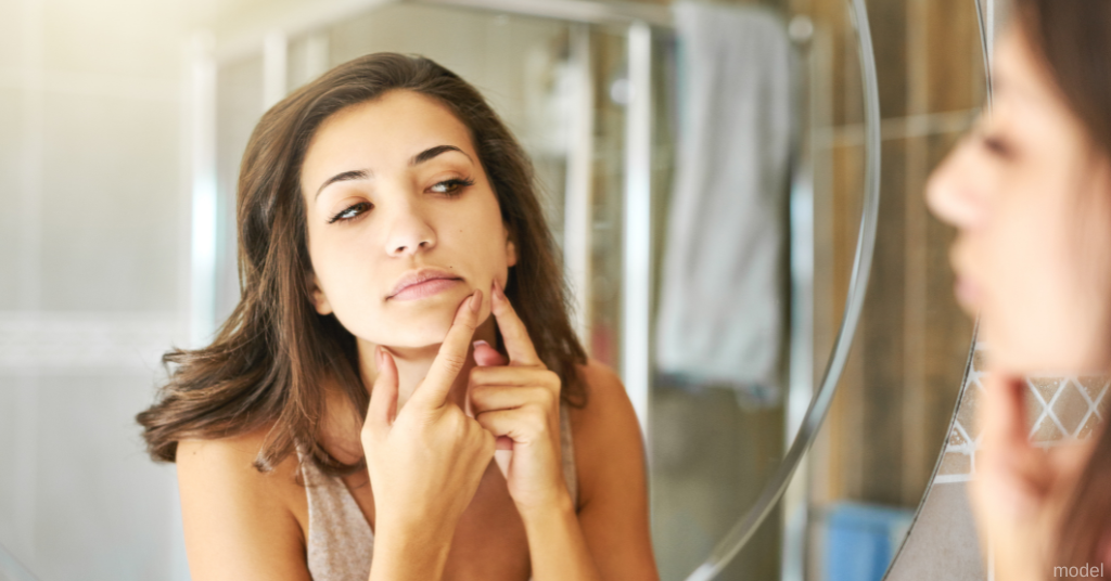 woman examining her acne in mirror (model)