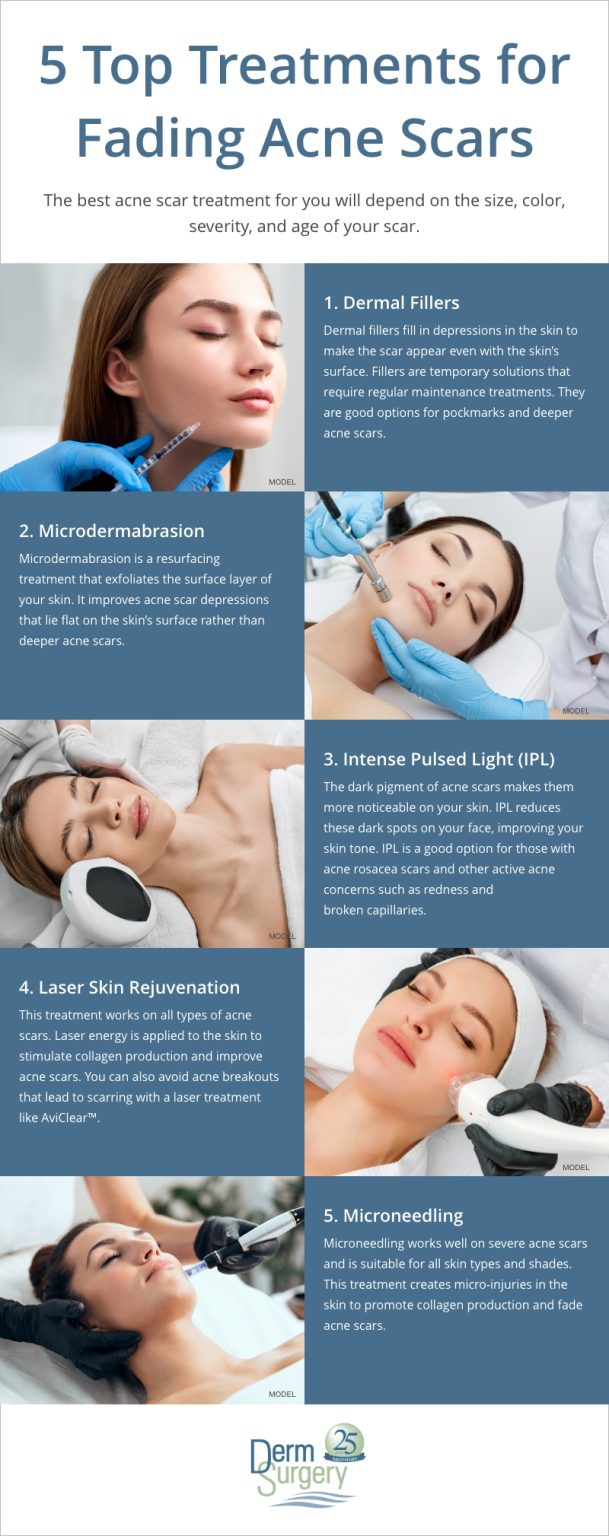 What Helps With Acne Scars? Treatment Options (INFOGRAPHIC