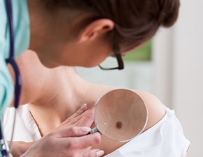 Who Needs Annual Skin Checks? You’d Be Surprised.