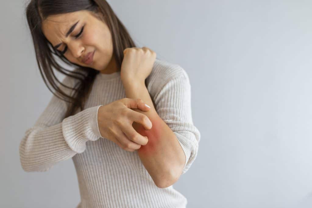 Psoriasis and You