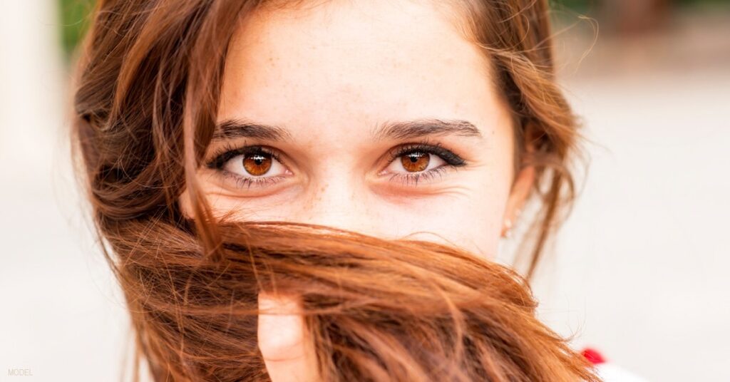 4 Easy Treatments to Fade Acne Scars