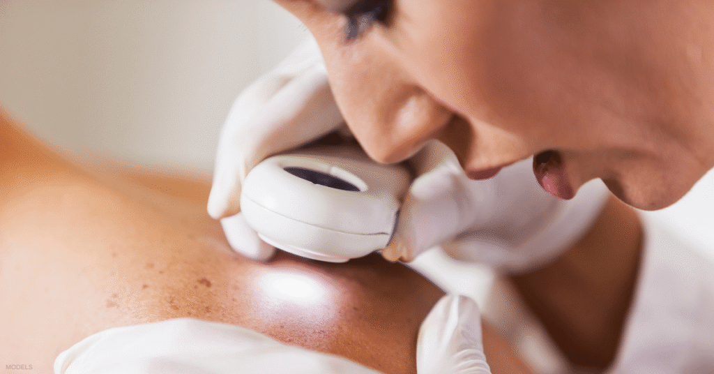 Mohs Surgery 101: Answering Your Most Commonly Asked Questions