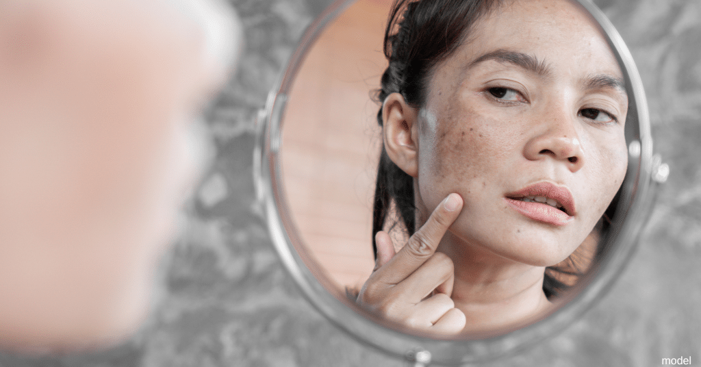 INFOGRAPHIC: Best Sun Damage Treatment Options Available at DermSurgery Associates