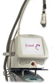 Fraxel laser.