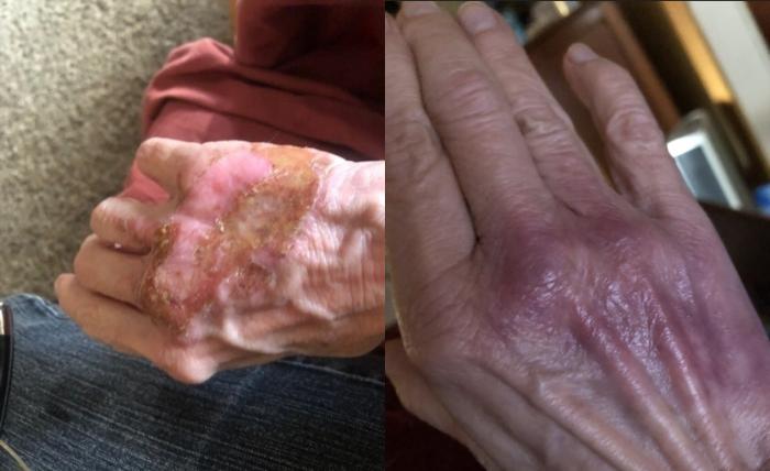 Before and After Image: Case #53 - front