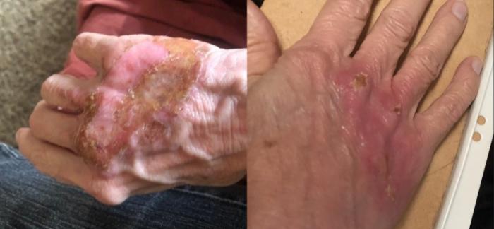 Before and After Image: Case #53 - front