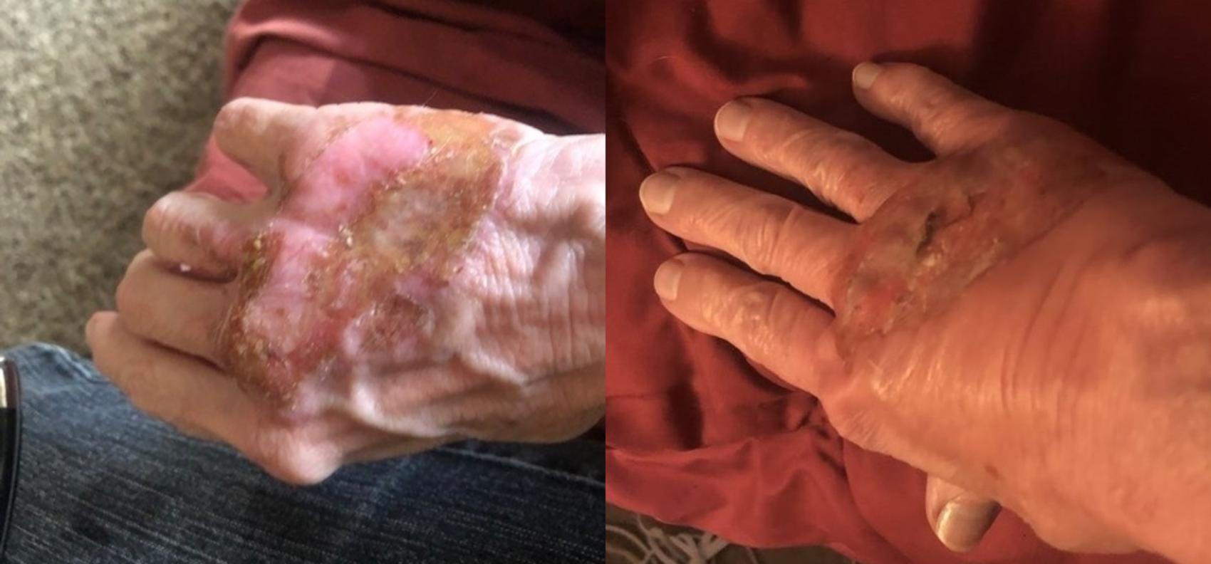 Before and After Image: Case #53 - front