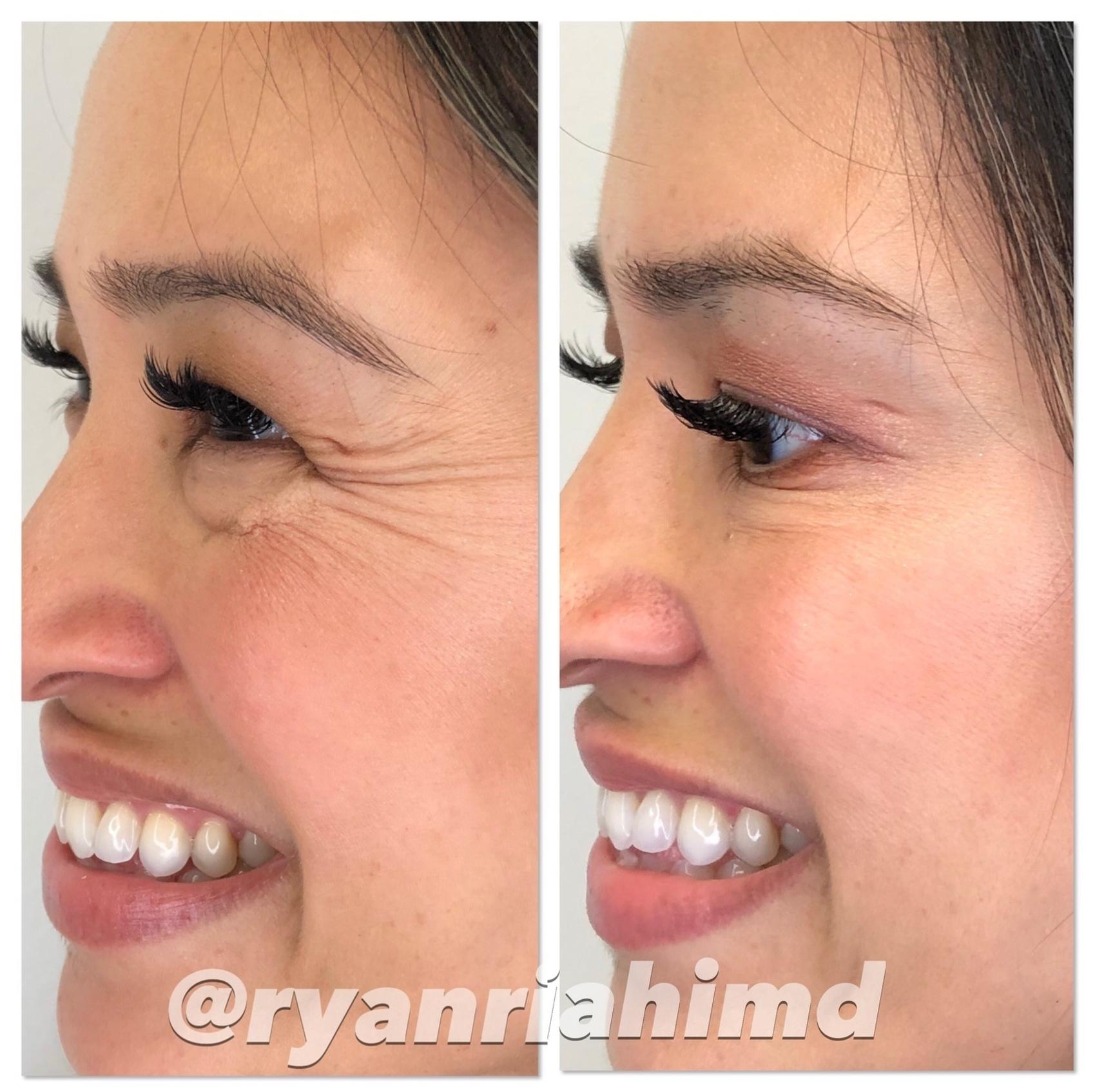 Before and After Image: Case #47 - left-front-oblique