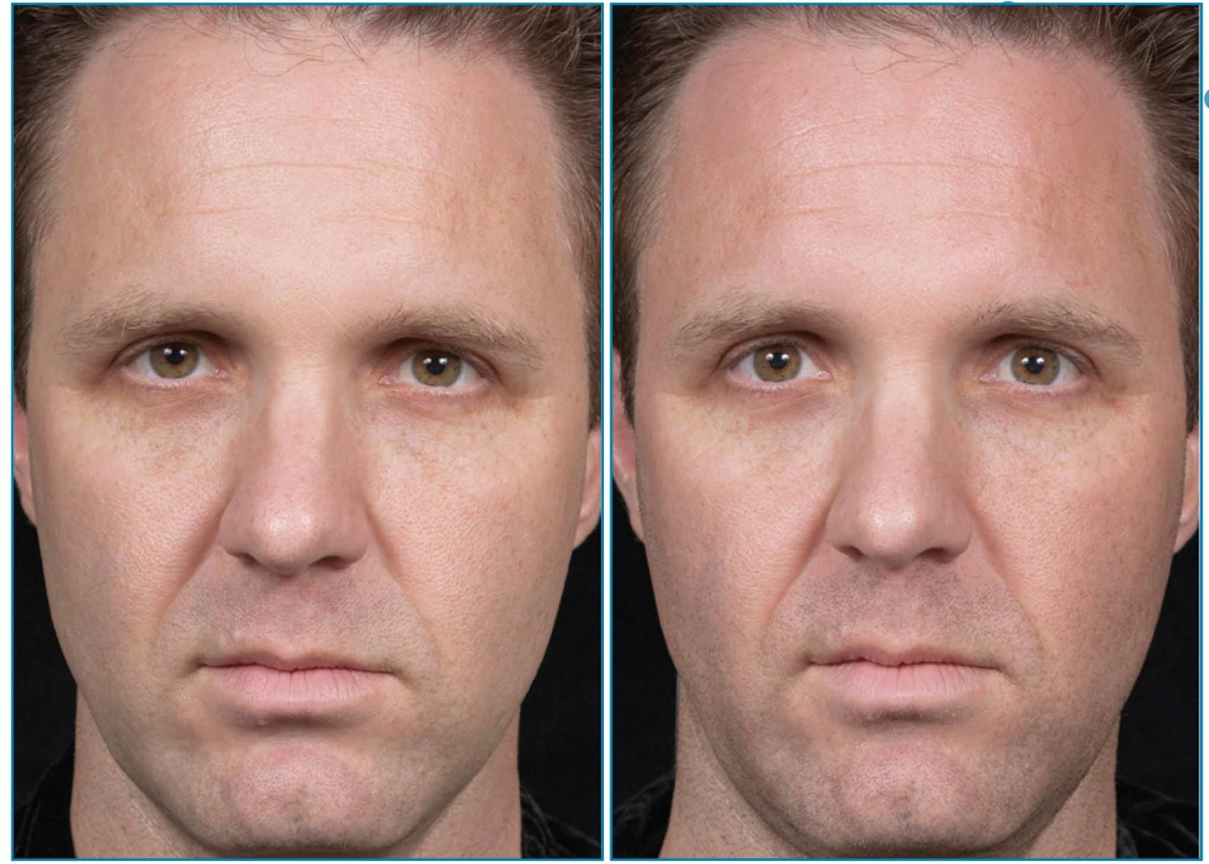 Before and After Image: Case #18 - front