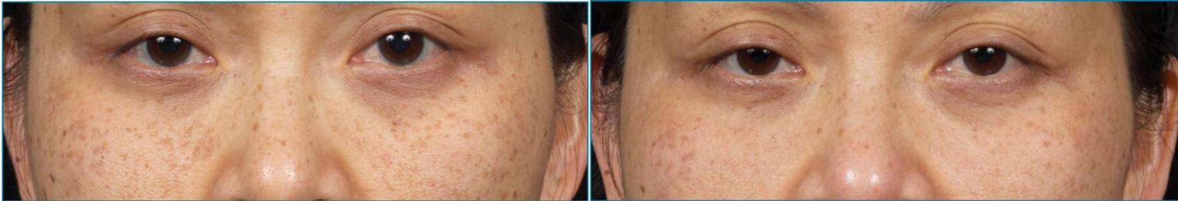 Before and After Image: Case #20 - front