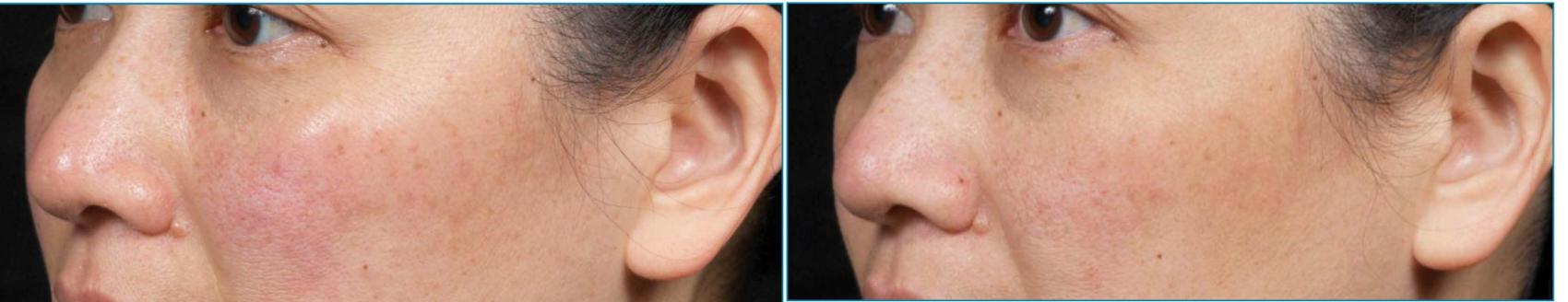 Before and After Image: Case #21 - left-front-oblique