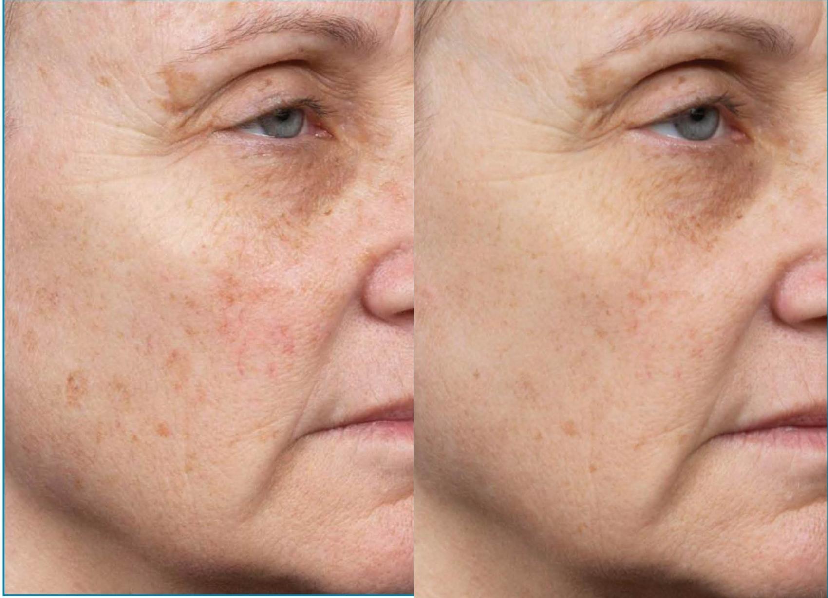 Before and After Image: Case #22 - right-front-oblique