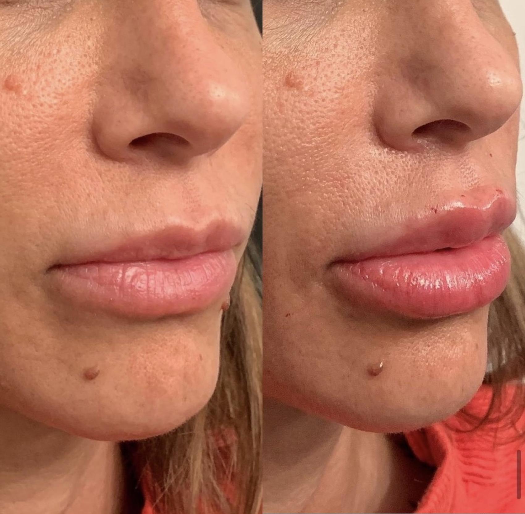 Before and After Image: Case #71 - right-front-oblique