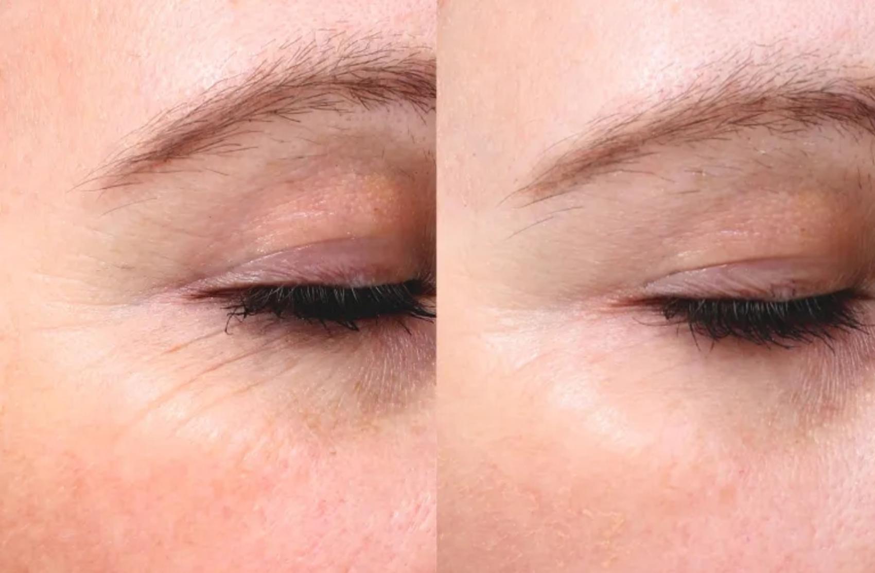 Before and After Image: Case #8 - right-front-oblique