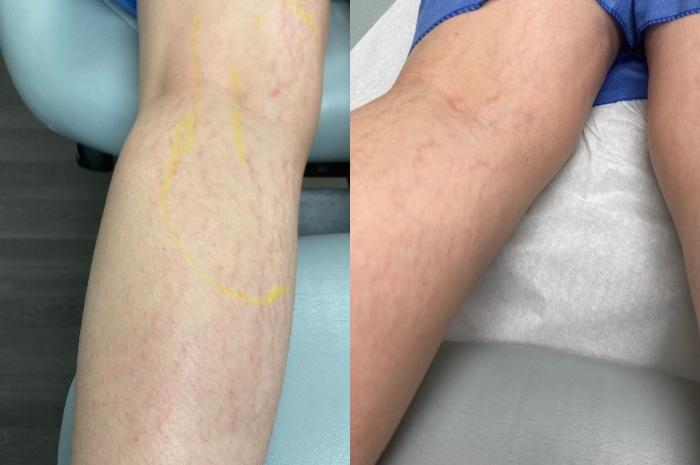 Before and After Image: Case #52 - back