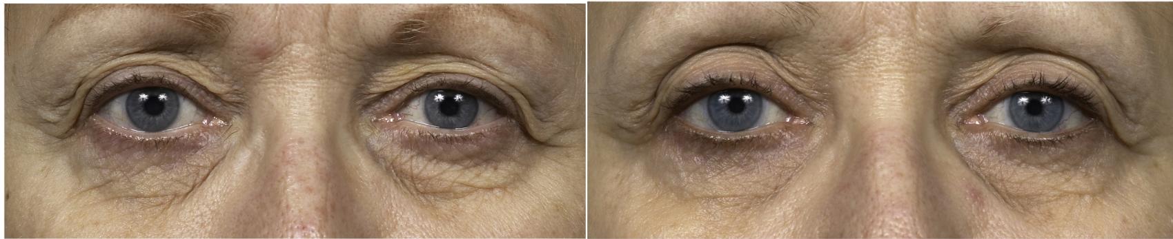 Before and After Image: Case #27 - front