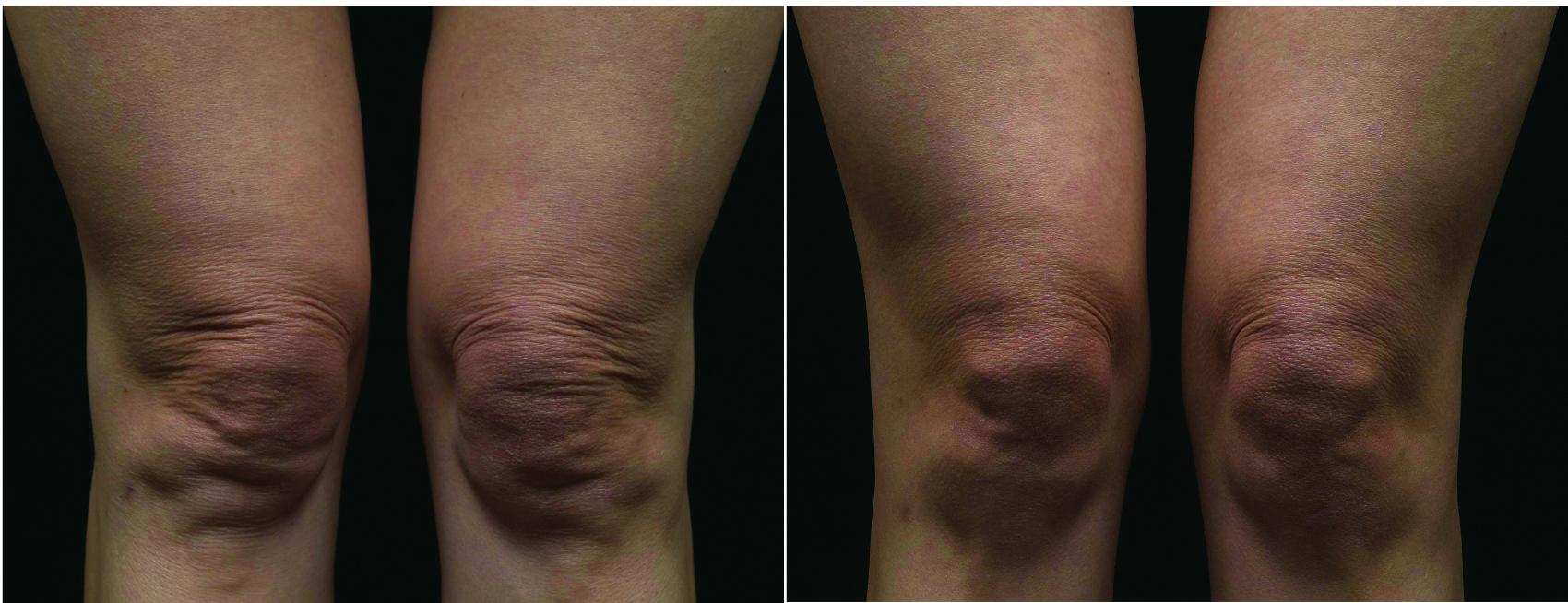 Before and After Image: Case #28 - front