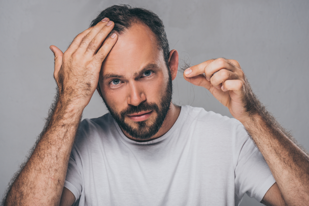 Man grabs at his scalp, displeased with early hair loss.