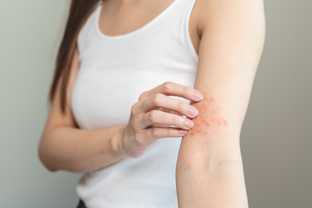 Close-up of eczema-related redness and irritation on the inner arm, possibly triggered by allergies or skin sensitivity.